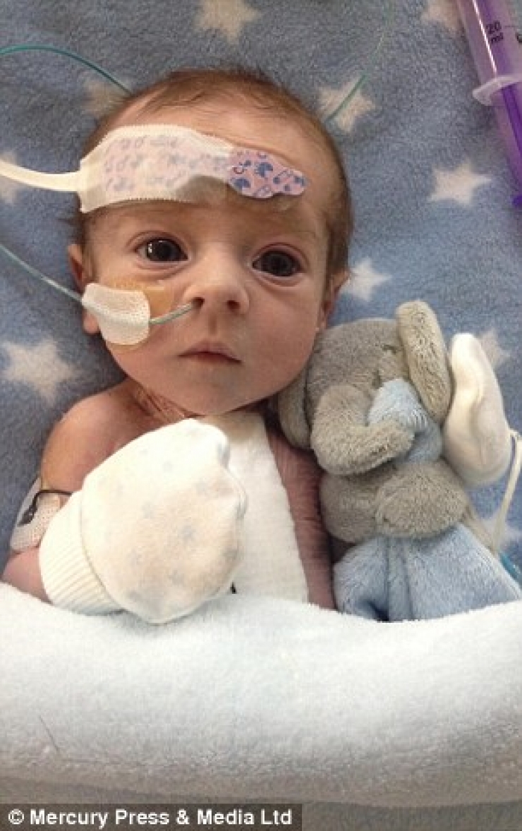 Illustration de l'article : N&eacute; avec la moiti&eacute; d'un coeur, ce b&eacute;b&eacute; n'aurait pas du rester en vie... C'est un vrai miracle !