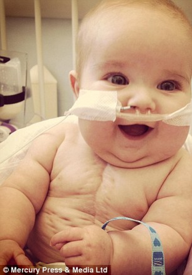 Illustration de l'article : N&eacute; avec la moiti&eacute; d'un coeur, ce b&eacute;b&eacute; n'aurait pas du rester en vie... C'est un vrai miracle !