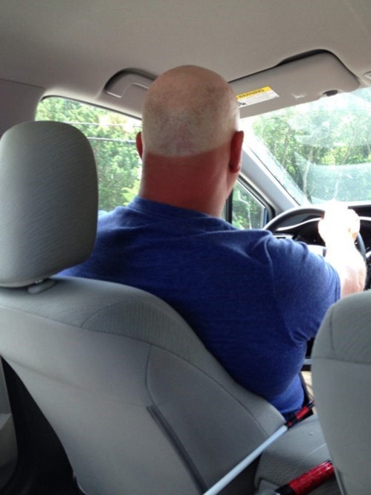 Illustration de l'article : 12 fails de bronzage magistraux