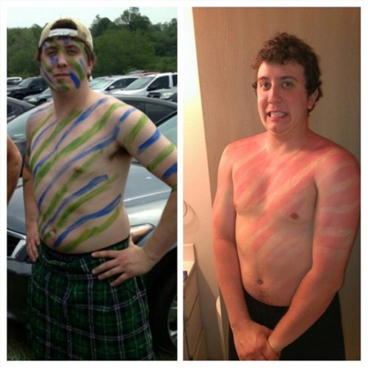 Illustration de l'article : 12 fails de bronzage magistraux