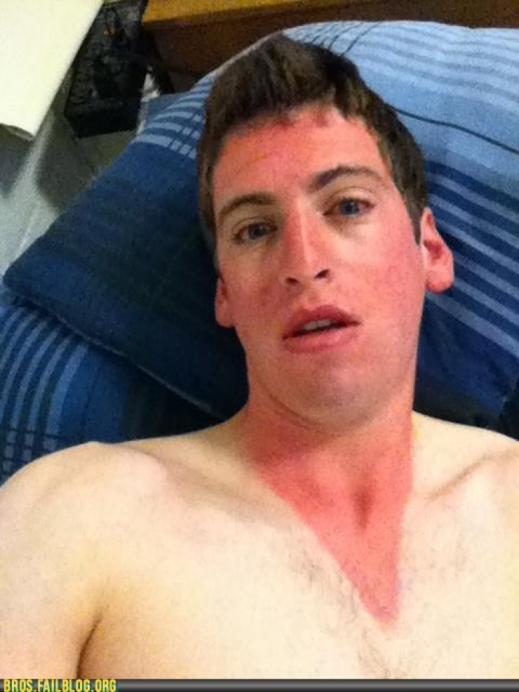 Illustration de l'article : 12 fails de bronzage magistraux