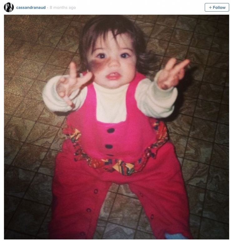 Illustration de l'article : On lui dit de retirer cette sale tache de son visage et ce qu'elle r&eacute;pond est PARFAIT !