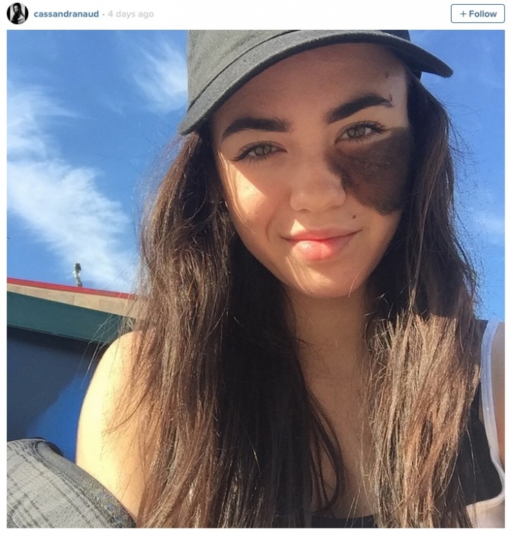 Illustration de l'article : On lui dit de retirer cette sale tache de son visage et ce qu'elle r&eacute;pond est PARFAIT !