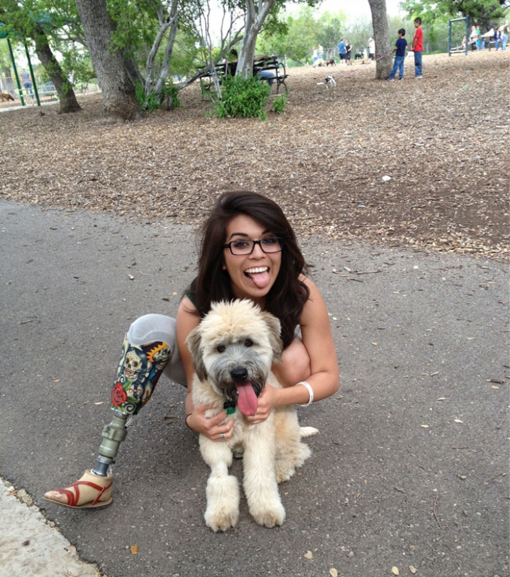 Illustration de l'article : Ces 23 femmes handicap&eacute;es s'assument et n'ont pas peur de s'afficher ! Respect !