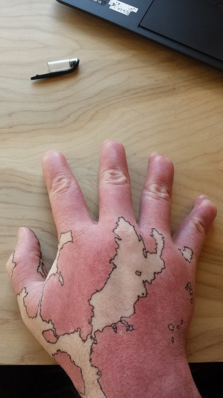 Illustration de l'article : Il dessine des îles et des côtes sur son bras pour une bonne raison
