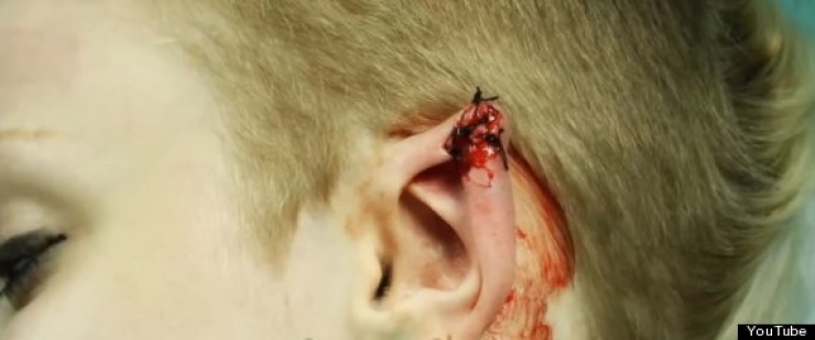 Illustration de l'article : Elle s'est faite opérer pour avoir quelque chose d'inimaginable...Drôle de passion...