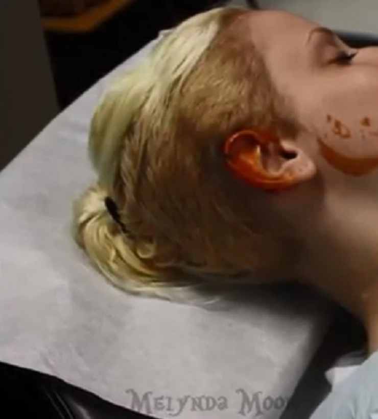 Illustration de l'article : Elle s'est faite opérer pour avoir quelque chose d'inimaginable...Drôle de passion...