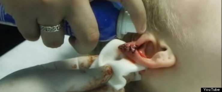 Illustration de l'article : Elle s'est faite op&eacute;rer pour avoir quelque chose d'inimaginable...Dr&ocirc;le de passion...