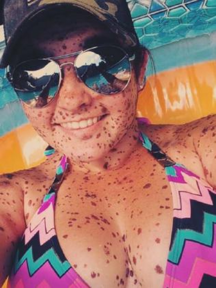 Illustration de l'article : Intimid&eacute;e &agrave; cause de son anomalie rare, elle r&eacute;pond de la plus belle mani&egrave;re qui soit !