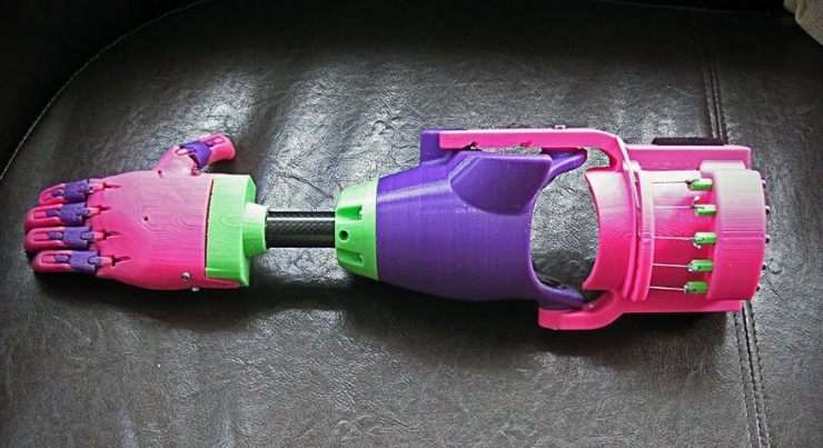 Illustration de l'article : Un designer priv&eacute; d'un bras redonne le sourire &agrave; une fillette qui a le m&ecirc;me handicap