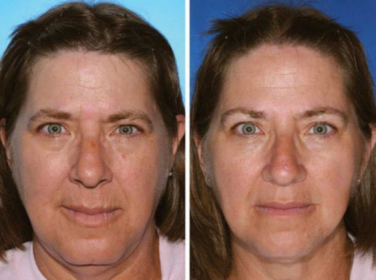 Illustration de l'article : Fumeurs Vs Non fumeurs... Ces 8 photos de jumeaux nous montrent que la diff&eacute;rence est flagrante !