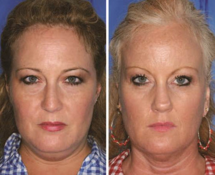 Illustration de l'article : Fumeurs Vs Non fumeurs... Ces 8 photos de jumeaux nous montrent que la diff&eacute;rence est flagrante !