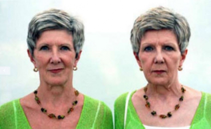 Illustration de l'article : Fumeurs Vs Non fumeurs... Ces 8 photos de jumeaux nous montrent que la diff&eacute;rence est flagrante !