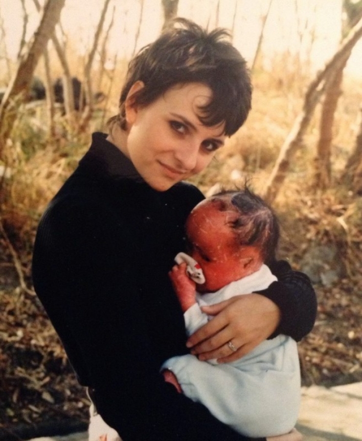 Illustration de l'article : On lui demandait de « cacher le visage hideux de ce bébé », mais admirez ce qu’elle est devenue !