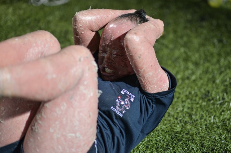 Illustration de l'article : On lui demandait de « cacher le visage hideux de ce bébé », mais admirez ce qu’elle est devenue !