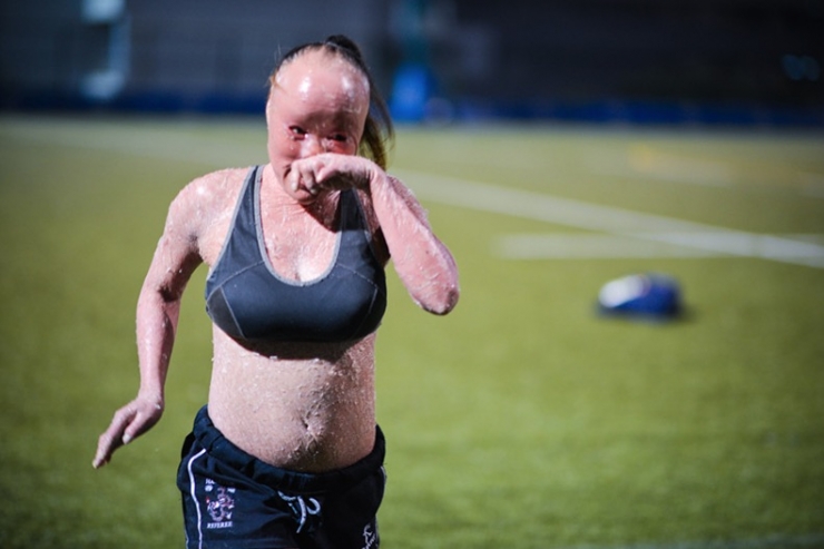 Illustration de l'article : On lui demandait de « cacher le visage hideux de ce bébé », mais admirez ce qu’elle est devenue !