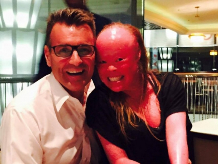 Illustration de l'article : On lui demandait de « cacher le visage hideux de ce bébé », mais admirez ce qu’elle est devenue !