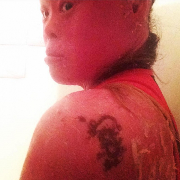 Illustration de l'article : On lui demandait de « cacher le visage hideux de ce bébé », mais admirez ce qu’elle est devenue !