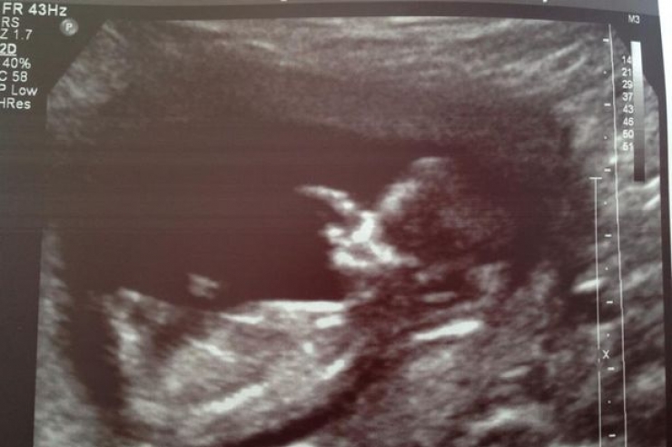 Illustration de l'article : Deux jours apr&egrave;s le d&eacute;c&egrave;s de son copain, elle fait une d&eacute;couverte miraculeuse! 