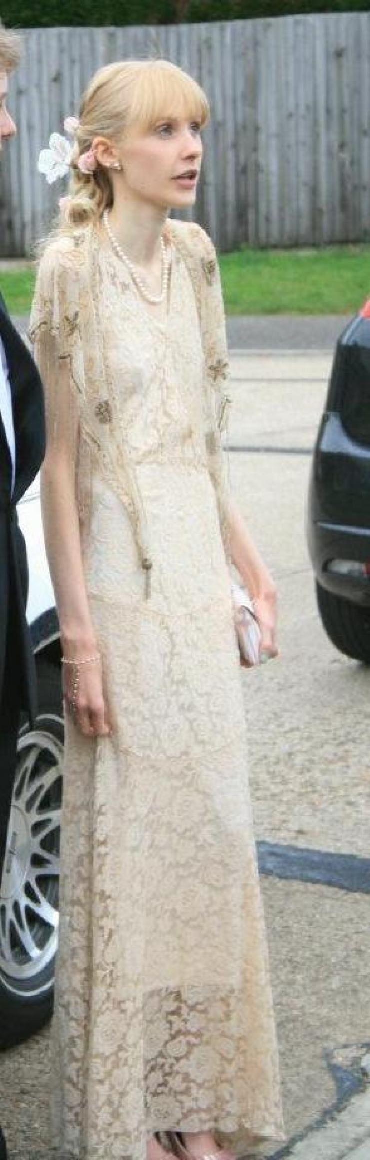 Illustration de l'article : En danger de mort, cette jeune femme anorexique a décidé de se prendre en main... Et quelle transformation !