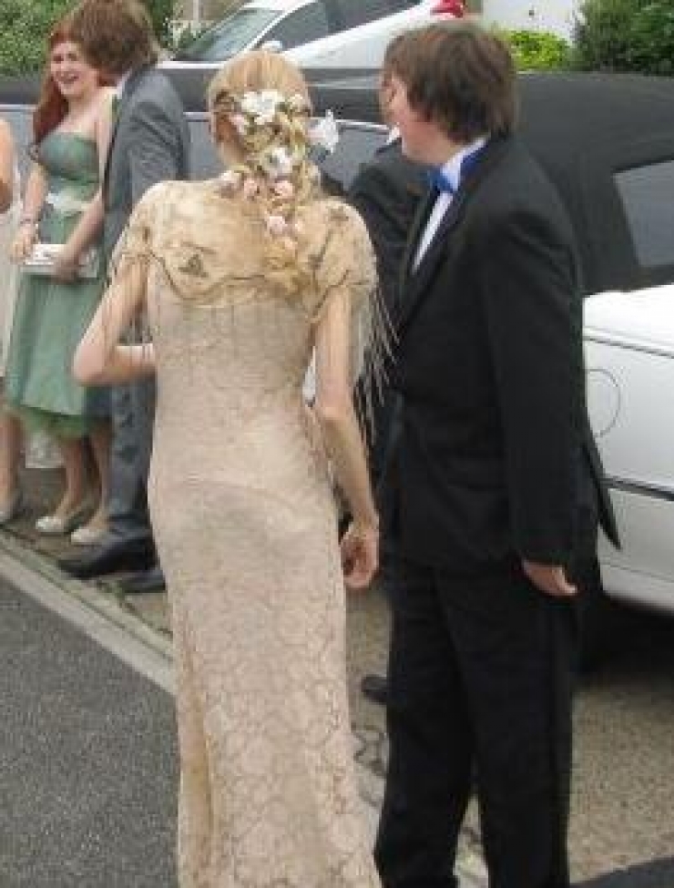 Illustration de l'article : En danger de mort, cette jeune femme anorexique a décidé de se prendre en main... Et quelle transformation !