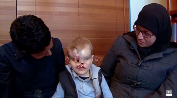 Illustration de l'article : Il &eacute;tait vou&eacute; &agrave; une vie mis&eacute;rable, sans nez et sans yeux mais la m&eacute;decine a fait un travail incroyable !