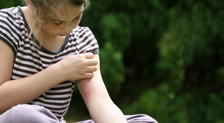 Illustration de l'article : L'astuce qu'il vous fallait pour stopper rapidement les d&eacute;mangeaisons caus&eacute;es par les moustiques !  