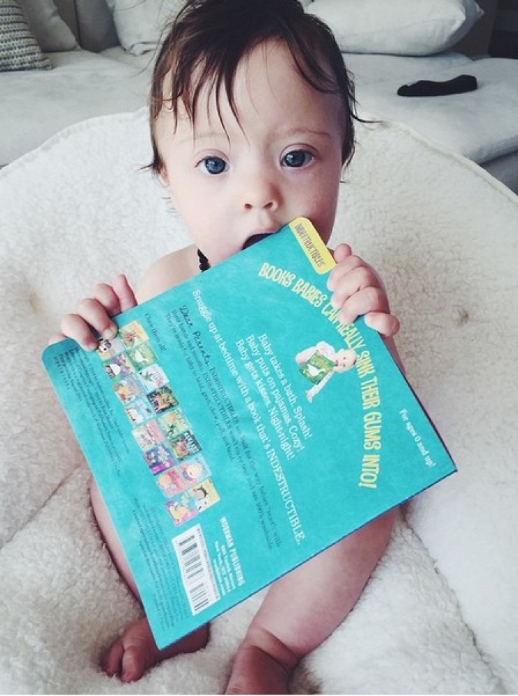 Illustration de l'article : Il n'a qu'un an pourtant ce petit bébé trisomique est déjà une grande vedette...