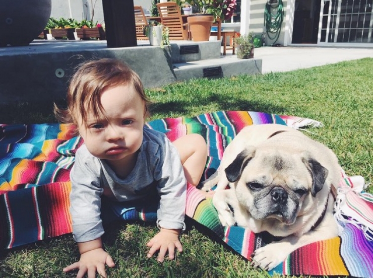 Illustration de l'article : Il n'a qu'un an pourtant ce petit b&eacute;b&eacute; trisomique est d&eacute;j&agrave; une grande vedette...