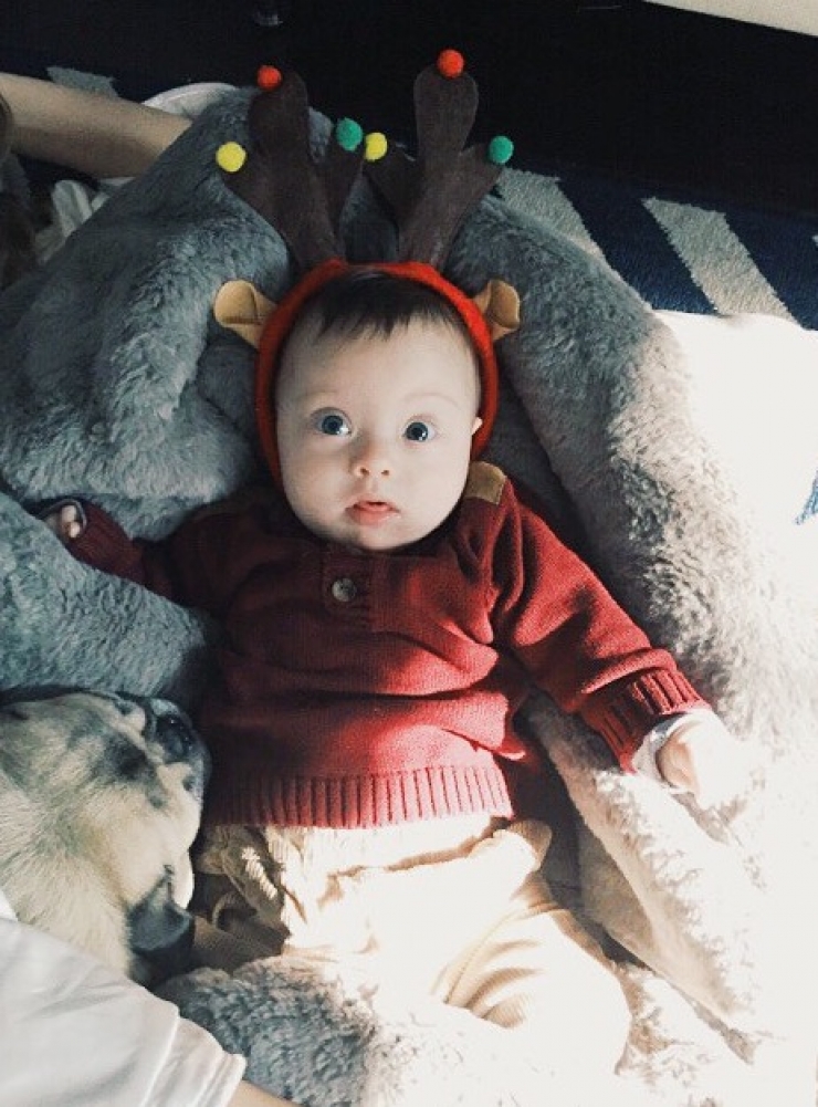 Illustration de l'article : Il n'a qu'un an pourtant ce petit bébé trisomique est déjà une grande vedette...