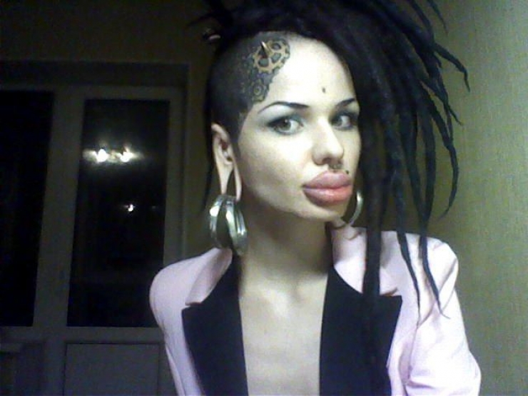 Illustration de l'article : Top 15 des chirurgies esth&eacute;tiques aux l&egrave;vres les plus pitoyables du moment. La 4 fait vraiment peur...