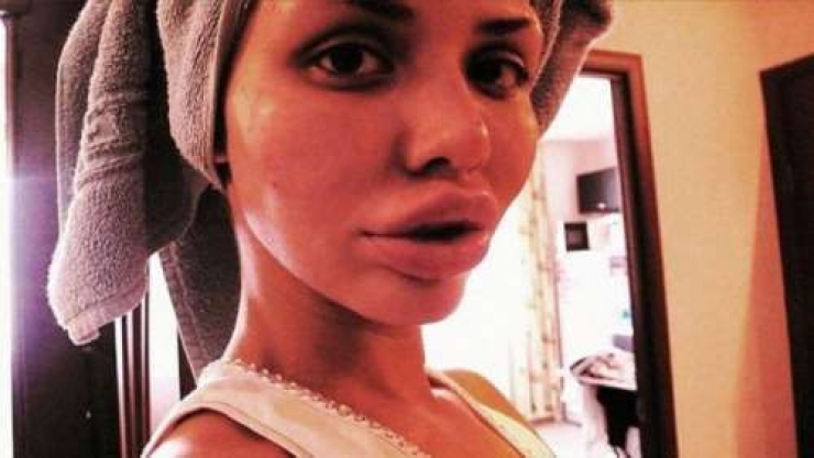 Illustration de l'article : Top 15 des chirurgies esth&eacute;tiques aux l&egrave;vres les plus pitoyables du moment. La 4 fait vraiment peur...