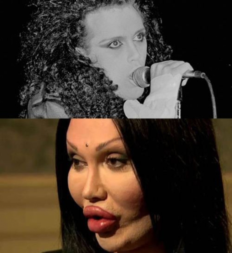 Illustration de l'article : Top 15 des chirurgies esth&eacute;tiques aux l&egrave;vres les plus pitoyables du moment. La 4 fait vraiment peur...