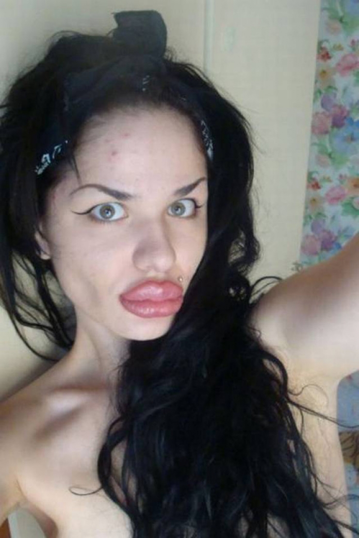 Illustration de l'article : Top 15 des chirurgies esth&eacute;tiques aux l&egrave;vres les plus pitoyables du moment. La 4 fait vraiment peur...