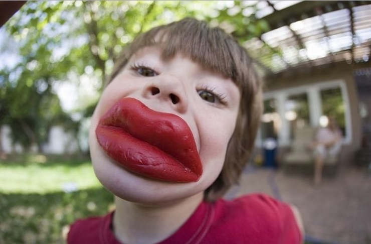 Illustration de l'article : Top 15 des chirurgies esth&eacute;tiques aux l&egrave;vres les plus pitoyables du moment. La 4 fait vraiment peur...