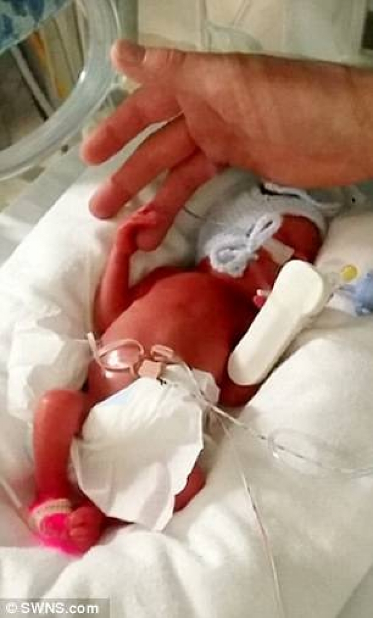 Illustration de l'article : Ils lui conseillent l'avortement, expliquant que le b&eacute;b&eacute; ne survivra jamais... Mais un miracle se produit ! 