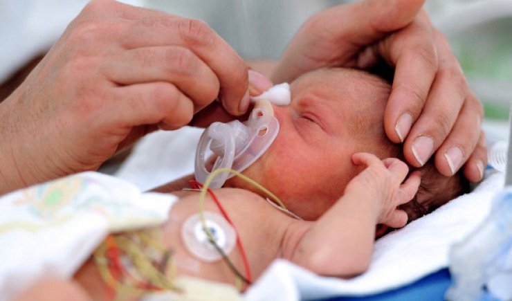 Illustration de l'article : Le petit Eli est n&eacute; sans nez mais avec un courage incroyable&hellip; Ce qu&rsquo;il est devenu met du baume au coeur ! 