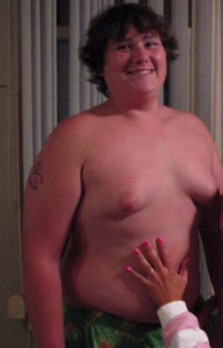 Illustration de l'article : Il a tenté tous les régimes mais en vain, jusqu'à ce qu'il essaie ceci...Et quel changement !