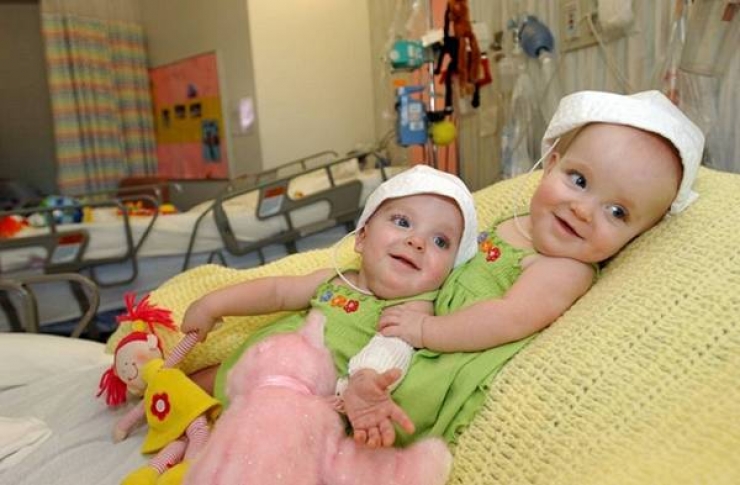 Illustration de l'article : Les deux jumelles qui se trouvent parmi ces tripl&eacute;s ont une particularit&eacute; tr&egrave;s rare...