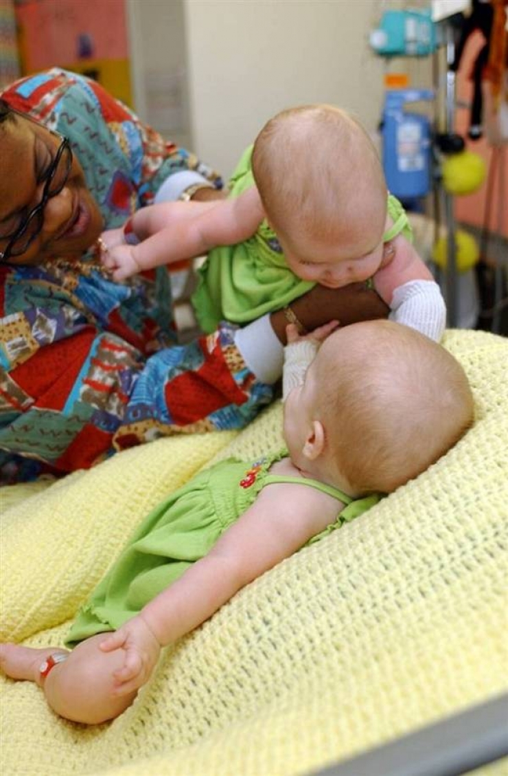 Illustration de l'article : Les deux jumelles qui se trouvent parmi ces tripl&eacute;s ont une particularit&eacute; tr&egrave;s rare...