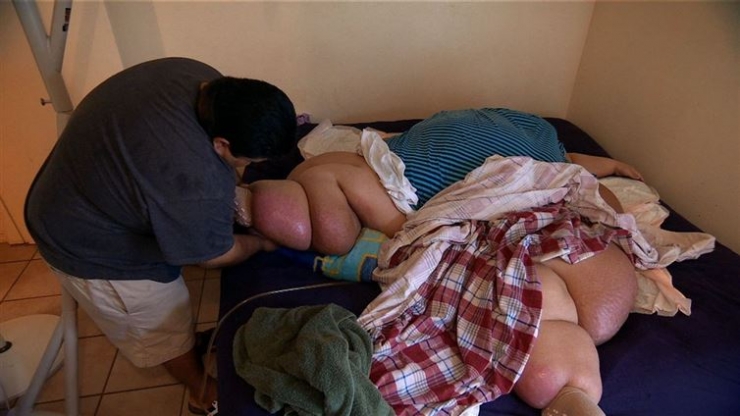 Illustration de l'article : À 466 kg elle se prend en main et perd 80 pourcents de son poids. Aujourd'hui elle est magnifique !