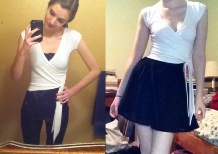 Illustration de l'article : 13 personnes souffrant d'anorexie s&eacute;v&egrave;re et qui ont r&eacute;ussi &agrave; s'en sortir ! Bravo...