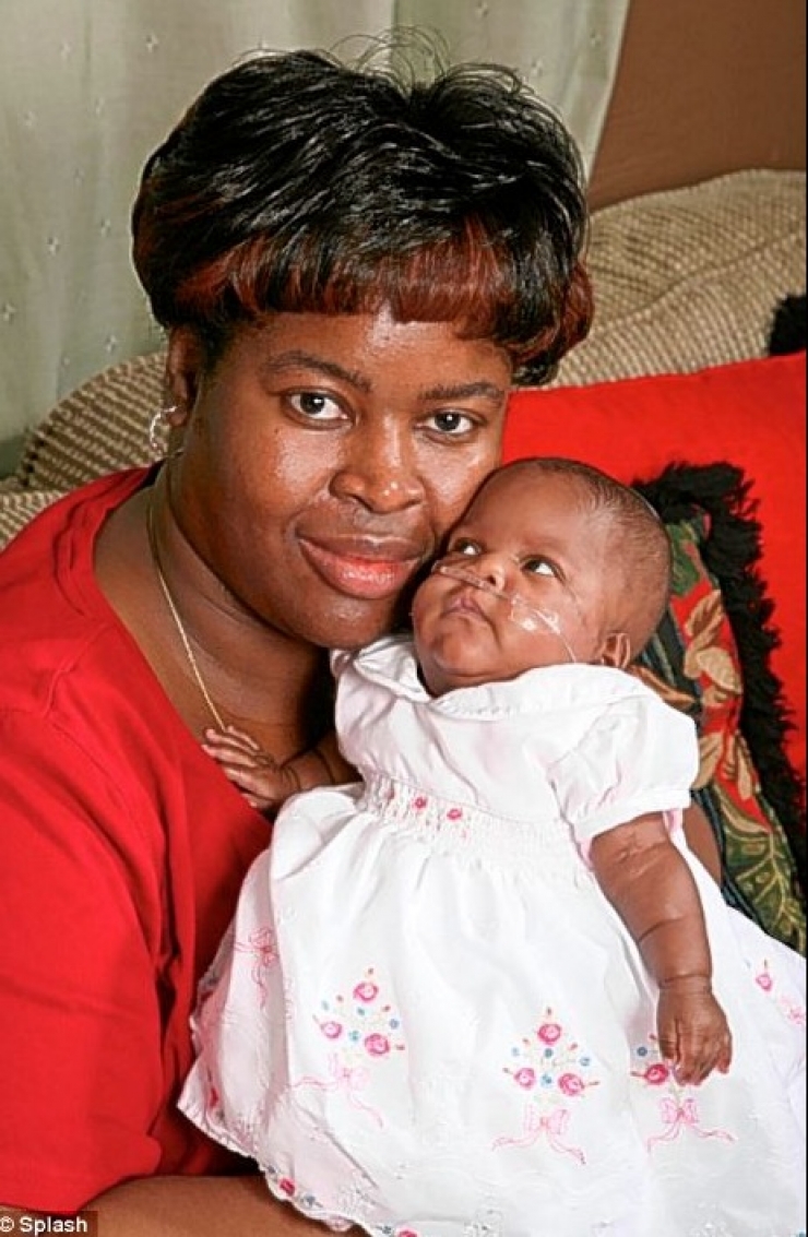 Illustration de l'article : Les docteurs ne donnaient aucune chance à ce foetus de 21 semaines...Et pourtant !