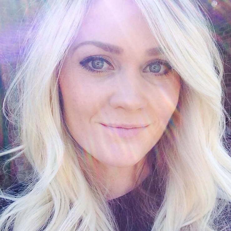 Illustration de l'article : Elle publie des photos choc d'elle pour montrer les dangers du bronzage