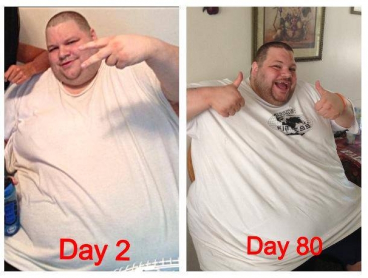 Illustration de l'article : En danger de mort, il perd 180kg en 2ans gr&acirc;ce &agrave; Taylor Swift ! Un joli combat...