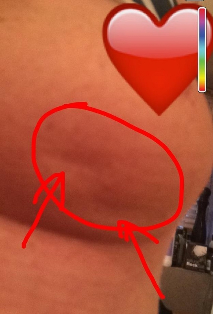 Illustration de l'article : Cette dame atteinte de cancer tient &agrave; sensibiliser les femmes en publiant une photo de sa poitrine...