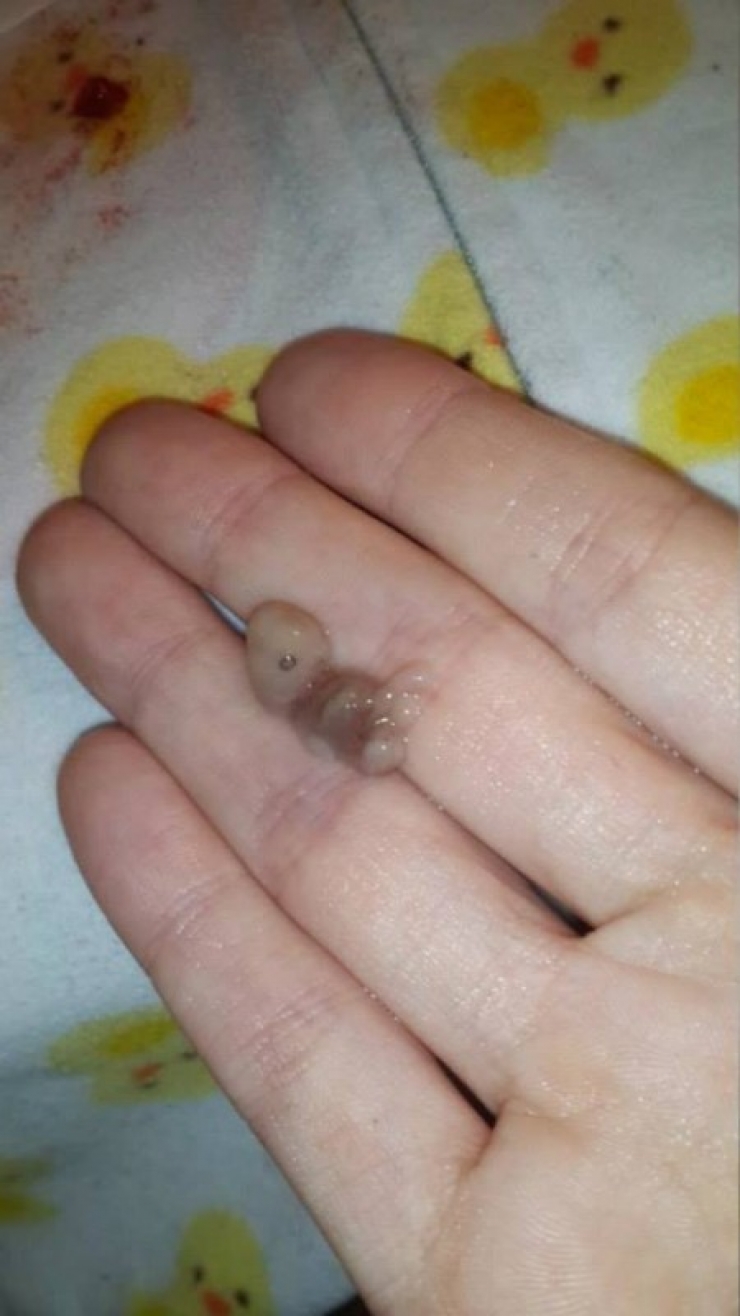 Ce Bebe Est Ne A 7 Semaines Ce Que Sa Mere Fait A Ete Critique Par Des Milliers De Personnes