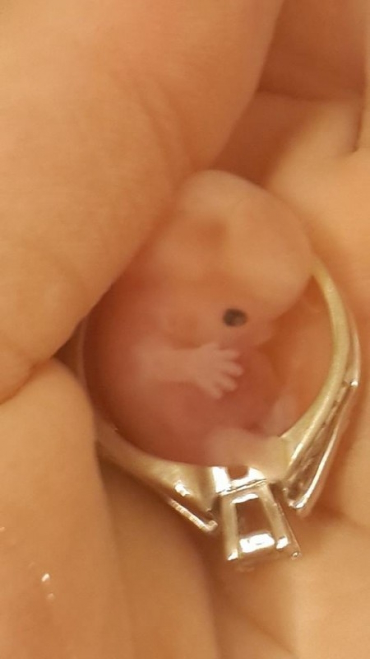 Ce Bebe Est Ne A 7 Semaines Ce Que Sa Mere Fait A Ete Critique Par Des Milliers De Personnes