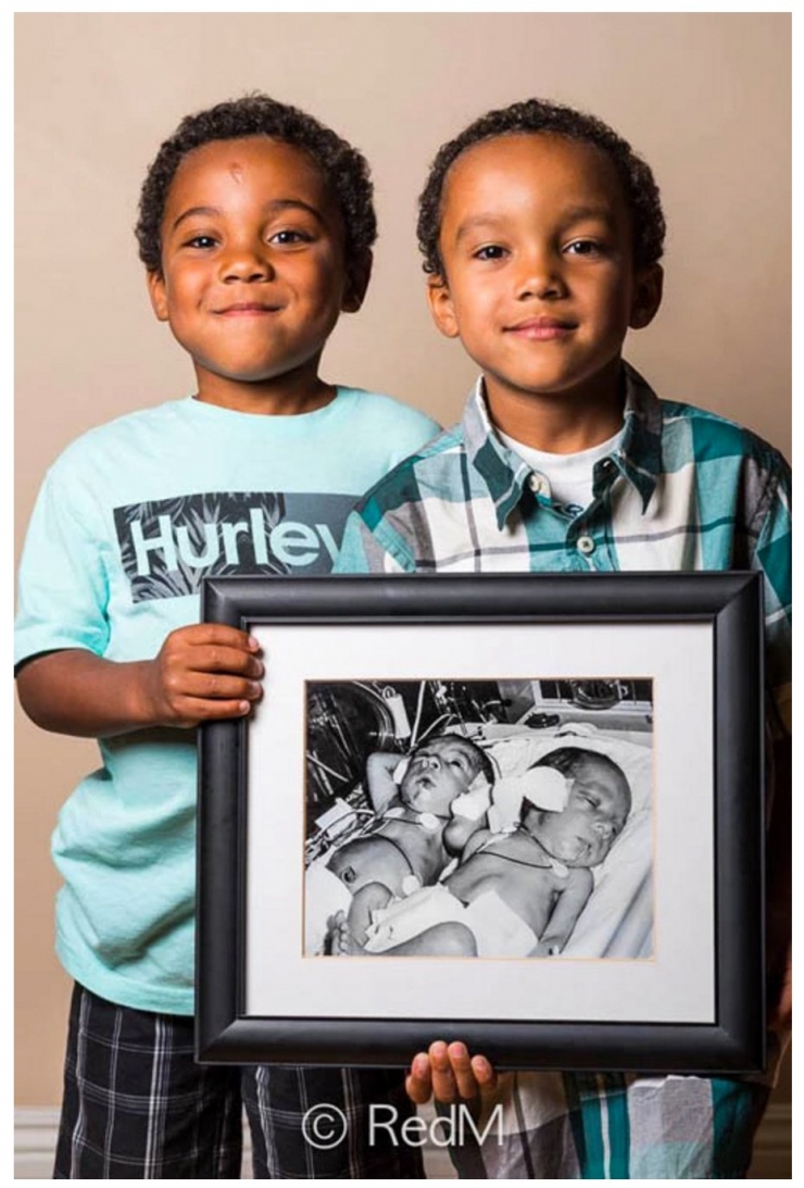 Illustration de l'article : Red Methot rend hommage aux bébés prématurés avec des photos avant/après qui font plaisir à voir ! 19 Clichés...