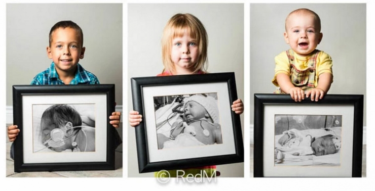 Illustration de l'article : Red Methot rend hommage aux bébés prématurés avec des photos avant/après qui font plaisir à voir ! 19 Clichés...